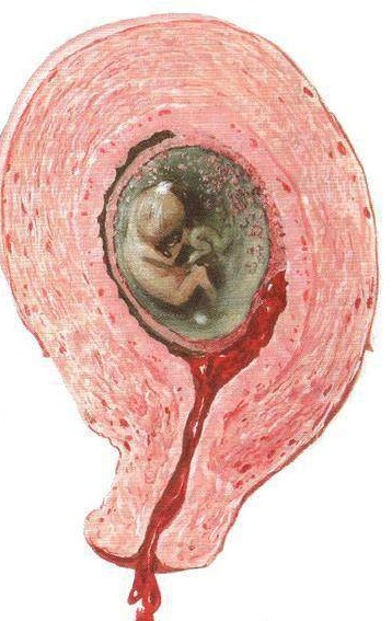 自带胰岛素水果