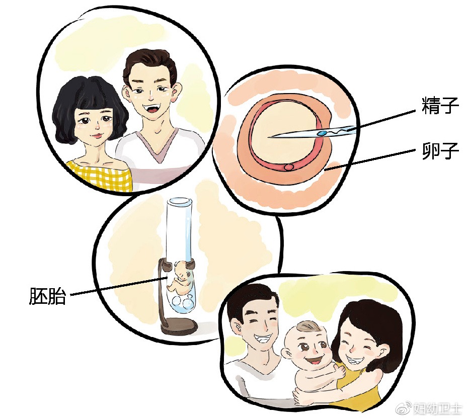 同房后怀男孩最早感觉