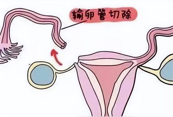 打胎需要证明吗?5个月以上