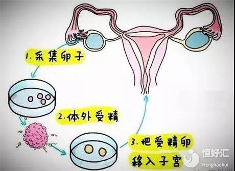 乳房按摩疏通